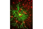 Ученые нашли способ восстанавливать нервные клетки